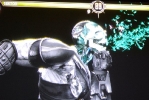 xray1