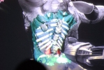 xray2